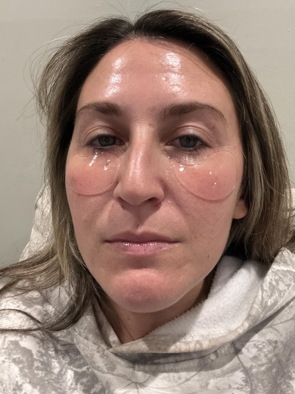 Patchology Serve Chilled Rosé Hydrating Under Eye Patches - Hyaluronic Acid & Antioxidant-Infused Eye Masks to Reduce Dark Circles, Puffiness & Fine Lines - Ideal Skincare Essentials (5 Pairs) customer photo 1