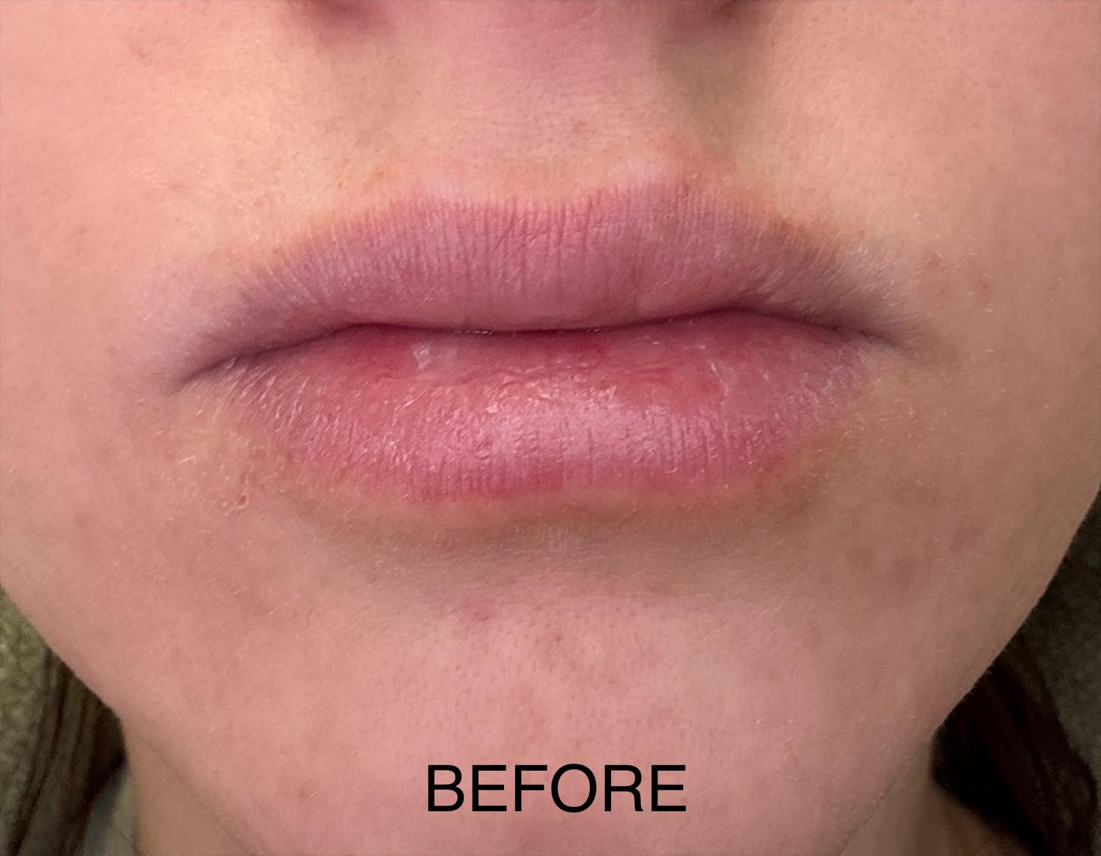 NuFACE FIX MicroWand Microcurrent Facial Device, FDA Cleared - Eyes, Lips & Lines Treatment with Serum Activator - Lip Plumper, Eye Depuffing Wand, Wrinkle & Smile Line Reducer, 3 On-The-Go Modes customer photo 1