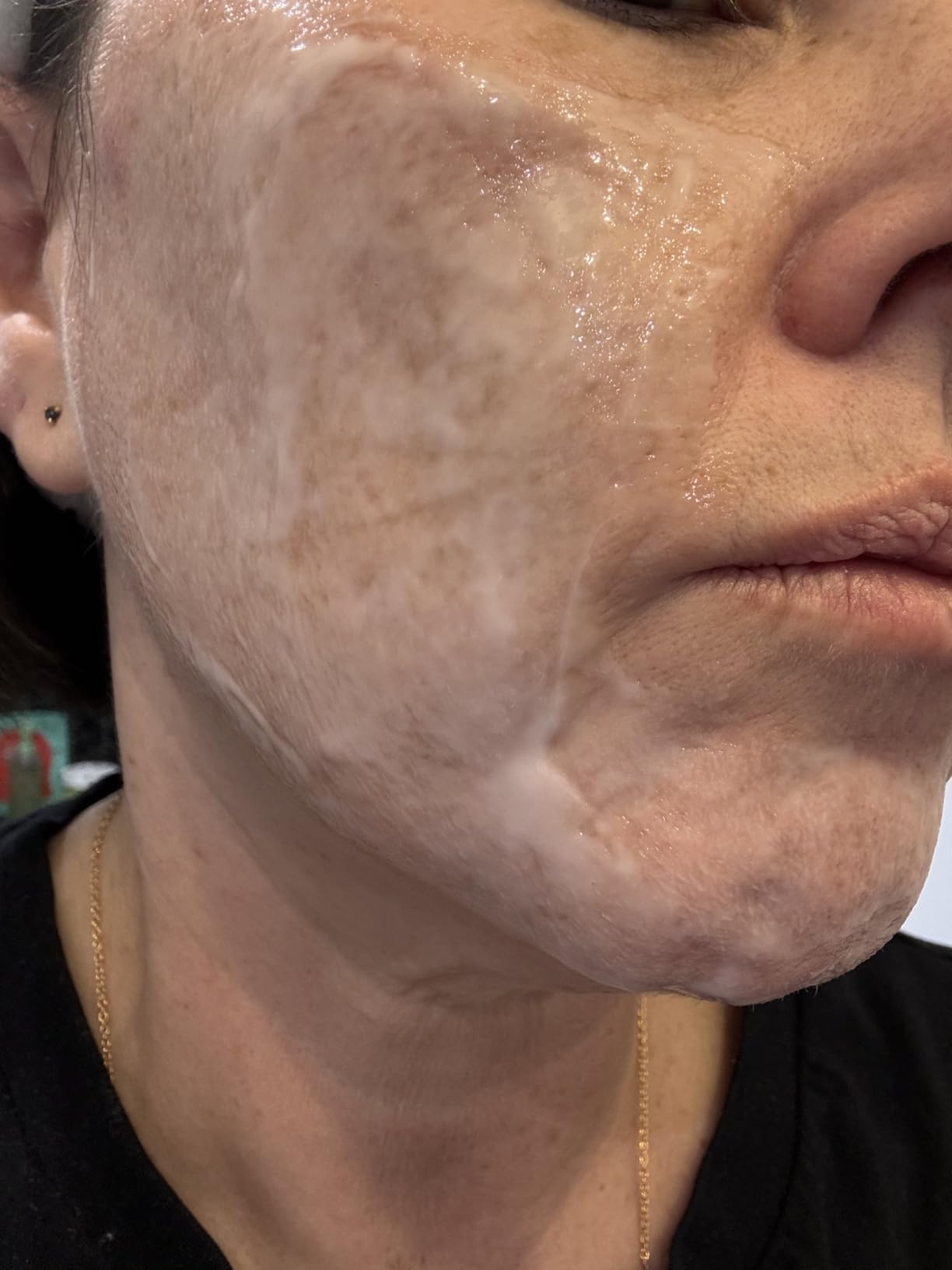 TOSOWOONG Real Collagen Fit, Hydrolyzed Collagen Wrapping Mask, Peel Off Facial Mask for elasticity, Hydrating, Glow, Glass Skin, Face Moisturizer, Self Care, Korean Skin Care, 50ml, 1.69 fl. oz. customer photo 2