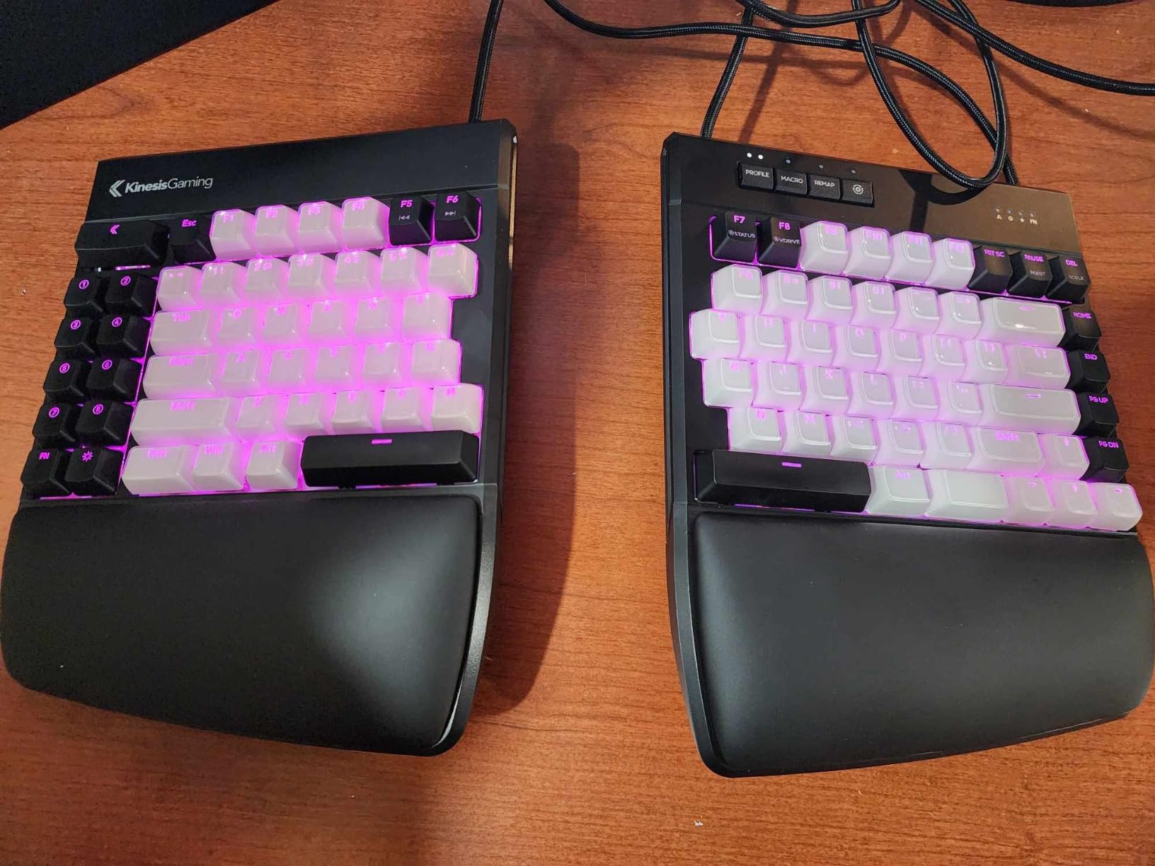 KINESIS Freestyle Edge RGB Plus Split Mechanical Keyboard | Hotswap Linear Switches | RGB | Ergonomic | Detachable Palm Support customer photo 1