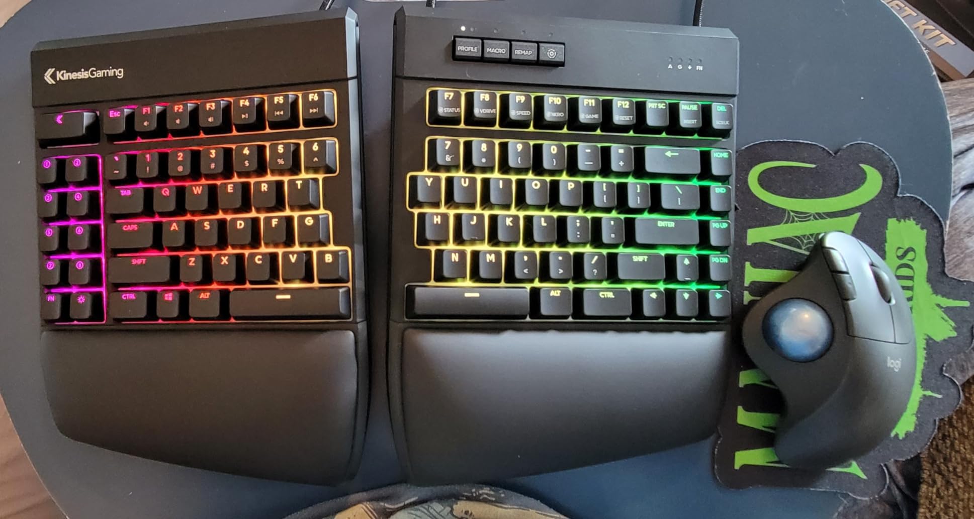 KINESIS Freestyle Edge RGB Plus Split Mechanical Keyboard | Hotswap Linear Switches | RGB | Ergonomic | Detachable Palm Support customer photo 2
