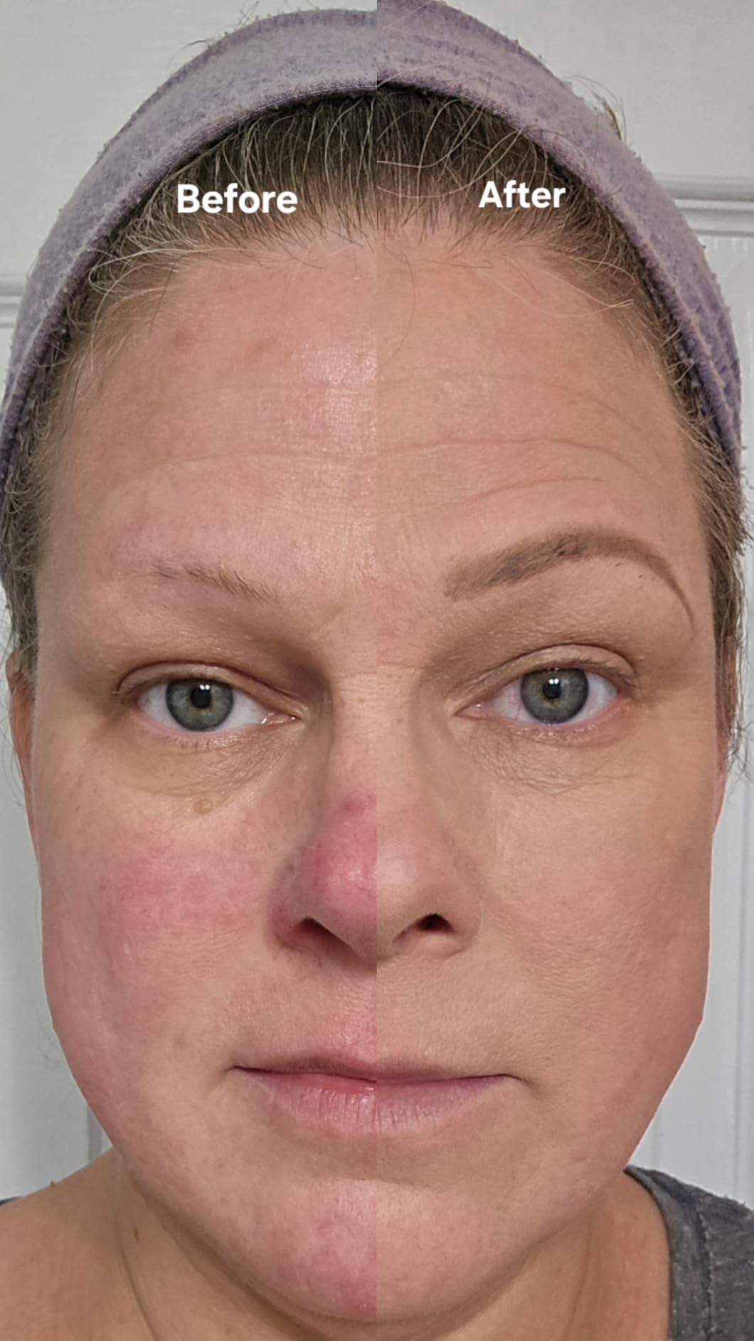 Neutrogena Retinol Treatment & Tinted Facial Moisturizer, Healthy Skin Anti-Aging Perfector, Broad Spectrum SPF 20 Sunscreen & Titanium Dioxide, Blendable Sheer Coverage, 30 Light to Neutral, 1 fl. Oz customer photo 1