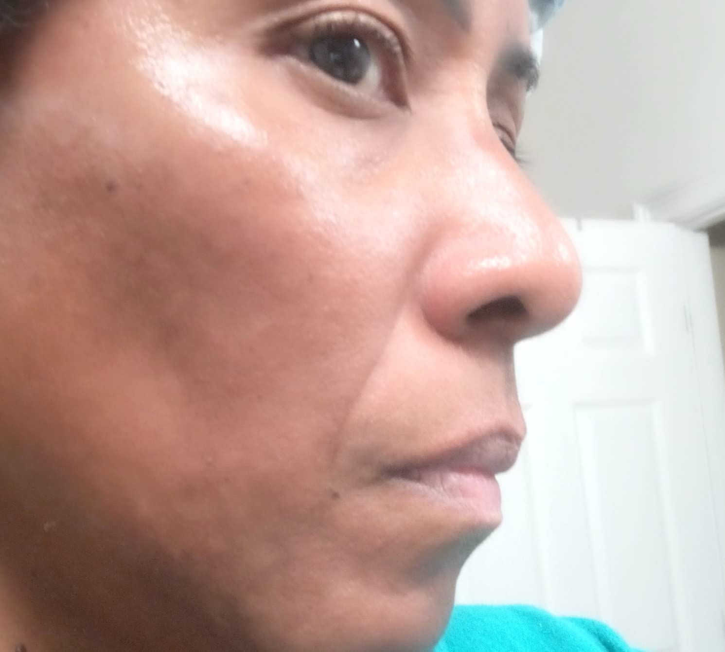 Eva Naturals Vitamin C Serum for Face - Anti Aging Dark Spot Remover & Corrector with Retinol, Hyaluronic Acid, Niacinamide & Salicylic Acid - Brightening, 1 fl oz customer photo 1