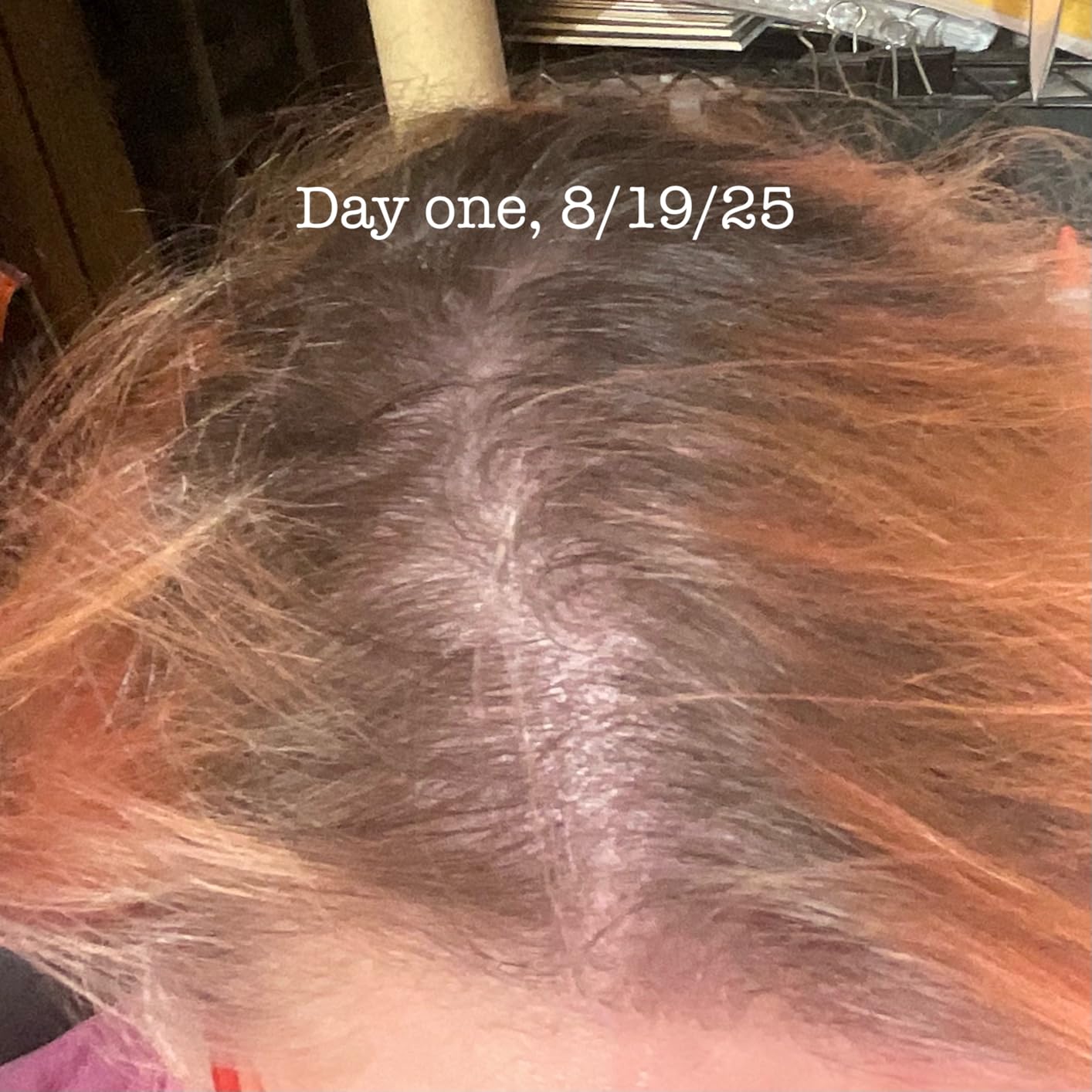Rosemary and Biotin Shampoo for Thinning Hair - Vegan Volumizing Shampoo for Fine Hair with B Vitamins Argan Oil & Tea Tree Essential Oil - Paraben Silicone and Sulfate Free Vegan Formula (8 Fl Oz) customer photo 2