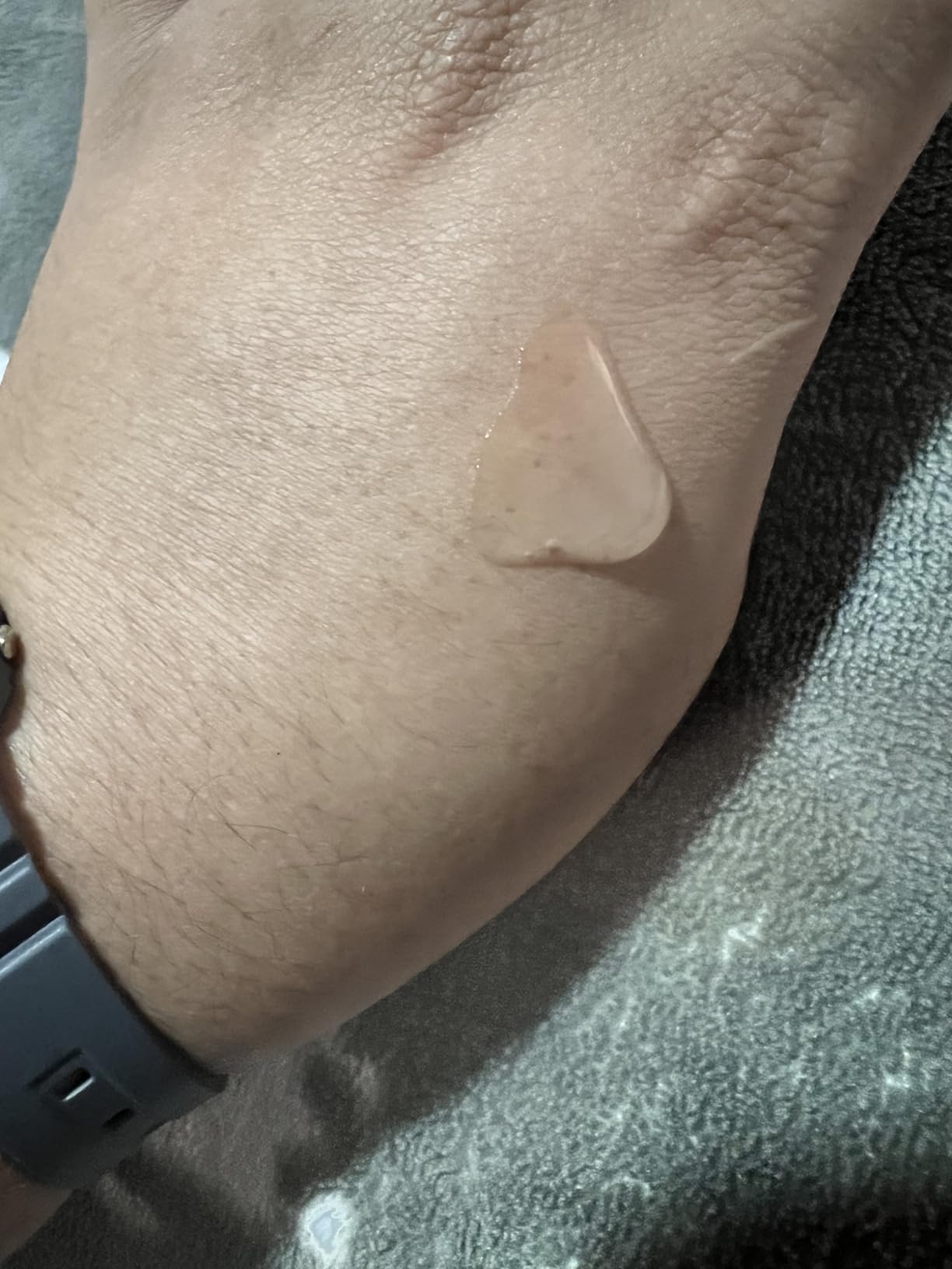 The Ordinary Niacinamide 10% + Zinc 1%, Smoothing Serum for Blemish-Prone Skin customer photo 2