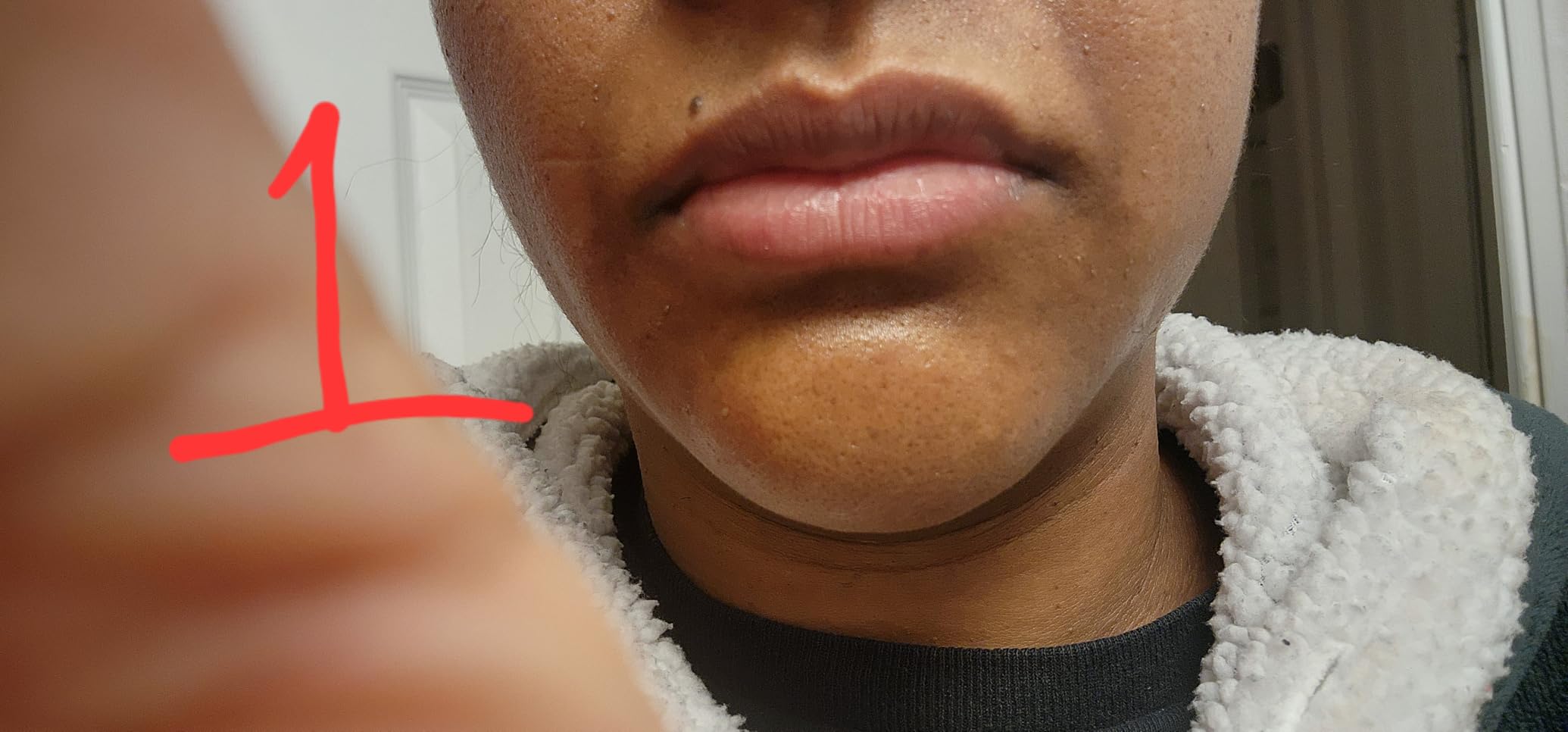 The Ordinary Retinol 0.2% in Squalane, Gentle Retinol Serum for the Face That Is Anti-Aging and Skin Smoothing, 1 Fl Oz customer photo 1