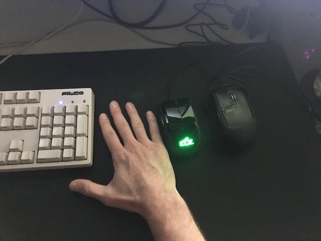 RBT Ergonomic Mouse Forearm-Based Clicking Reduces Finger & Wrist Strain-RSI Relief, High-Speed Control, Unique Vertical Grip, Shoulder-First Design for All-Day Comfort customer photo 1