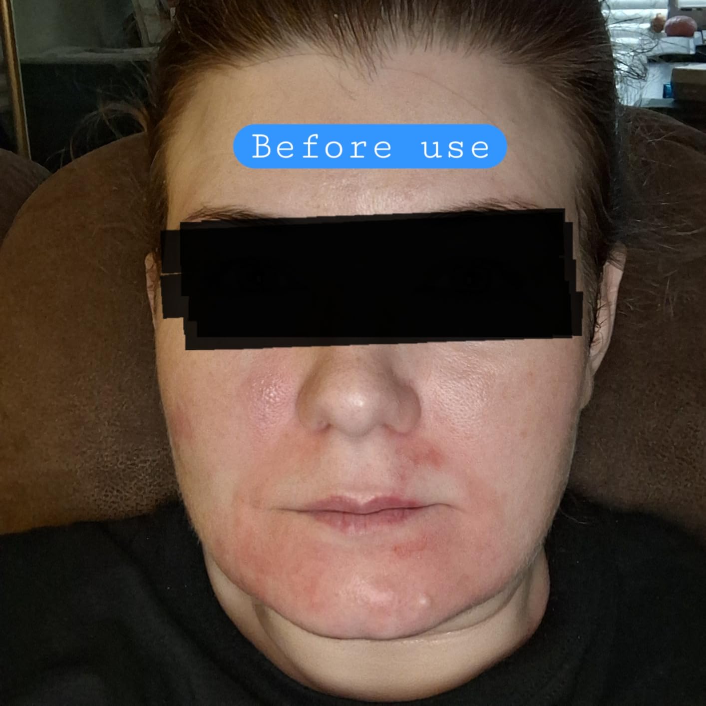 CeraVe Moisturizing Cream, Face Body Moisturizer, Normal to Dry Skin, 8 Fl Oz customer photo 1