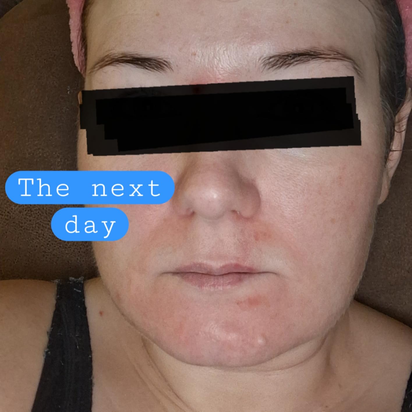 CeraVe Moisturizing Cream, Face Body Moisturizer, Normal to Dry Skin, 8 Fl Oz customer photo 2