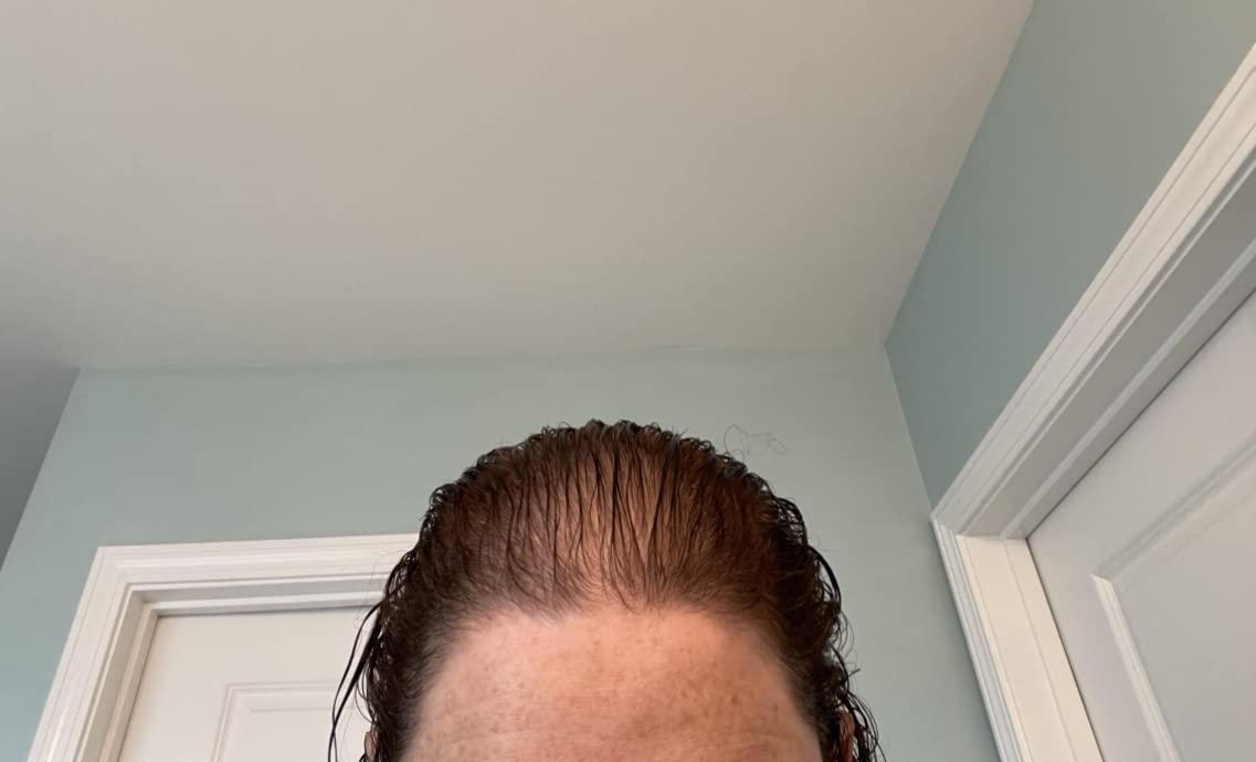 VEGAMOUR GRO Hair Serum for Hair Thinning & Shedding, Thicker Fuller Looking Hair In As Soon As 90 Days, Non Oily, Bergamot Scent, Vegan & Cruelty Free customer photo 2