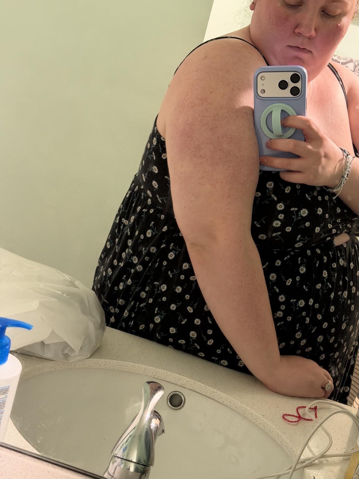First Aid Beauty - KP Bump Eraser Body Scrub with 10% AHA, Keratosis Pilaris Skin Exfoliater with Glycolic and Lactic acids, Helps Reduce Chicken Skin Bumps, Safe for Sensitive Skin, 4 oz customer photo 1