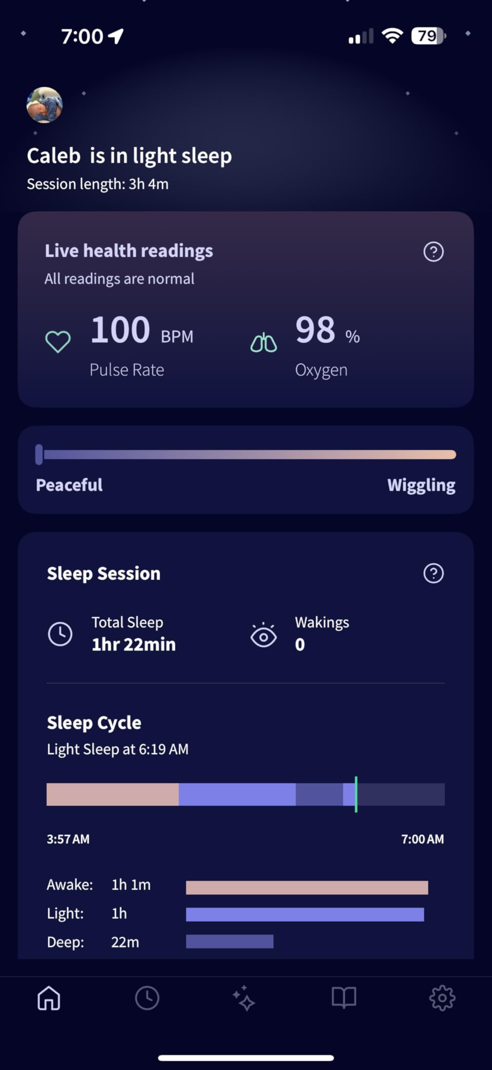 Owlet Dream Sock - Smart Baby Monitor View Heart Rate and Average Oxygen O2 as Sleep Quality Indicators customer photo 2