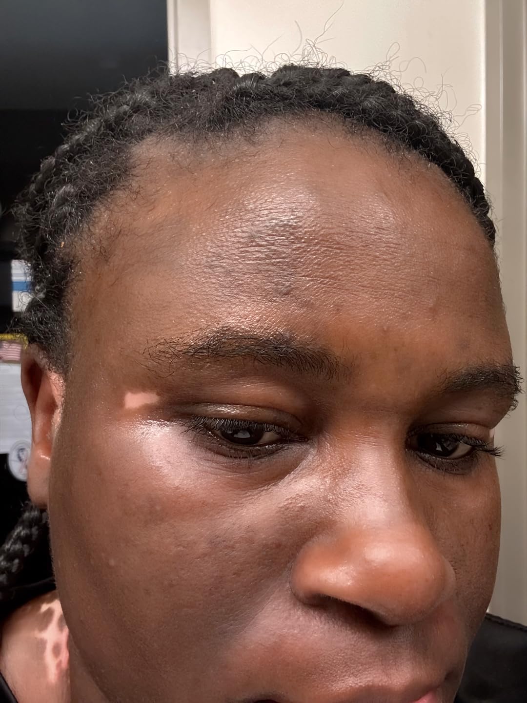 First Aid Beauty - Hydrating Eye Cream with Hyaluronic Acid, Nourishing Eye Cream that Provides 24 hours of Hydration, Helps Smooth Fine Lines, Wrinkles & Puffiness, Safe for Sensitive Skin, 0.5 oz customer photo 2