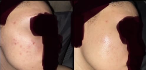 Good Molecules Discoloration Correcting Serum - Tranexamic Acid and Niacinamide Serum to Target Dark Spots and Hyperpigmentation - Skin Care for Face customer photo 1