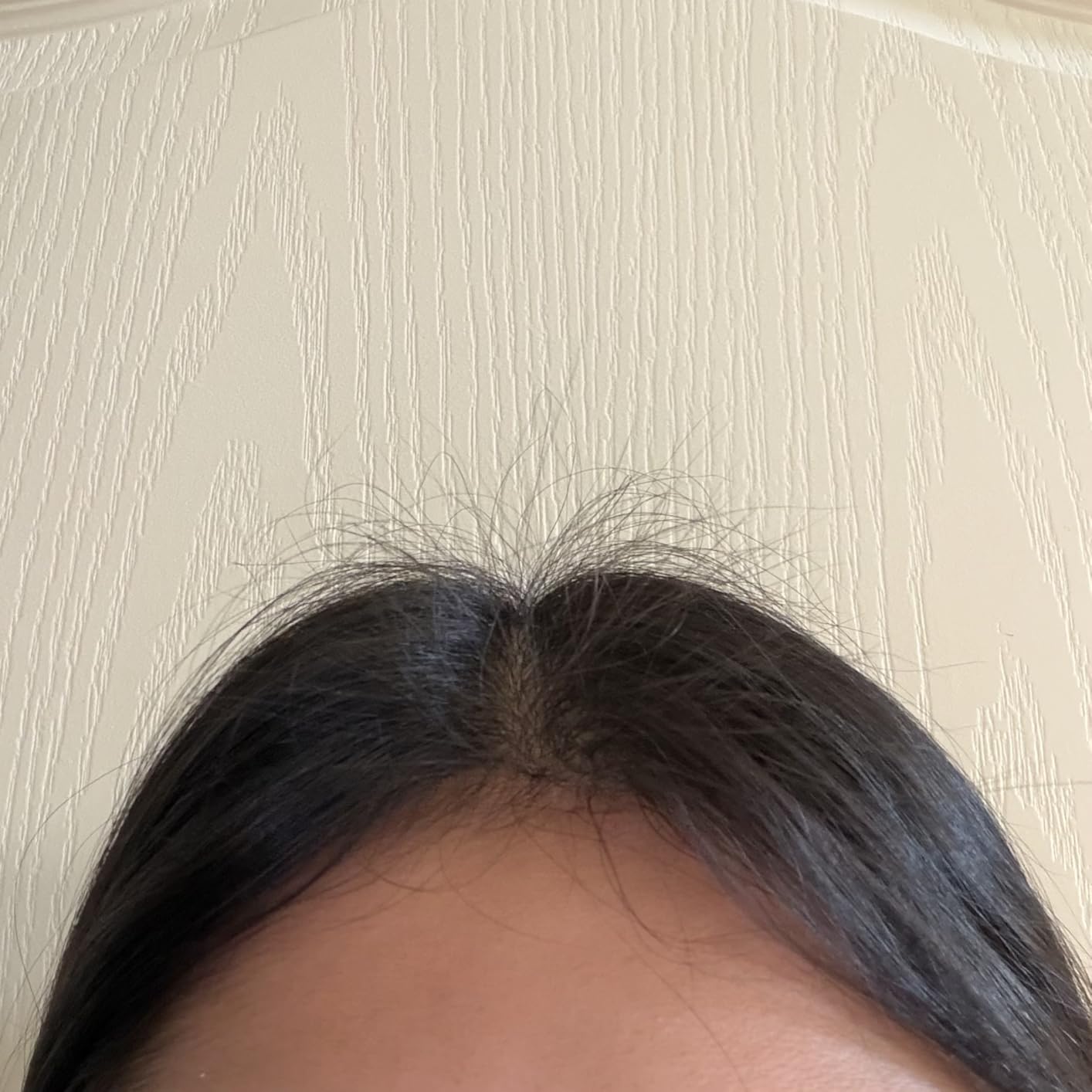 Nutrafol Women's Hair Serum, Supports Visibly Thicker and Stronger Hair, Vegan, Lightweight and Fast-Absorbing customer photo 1