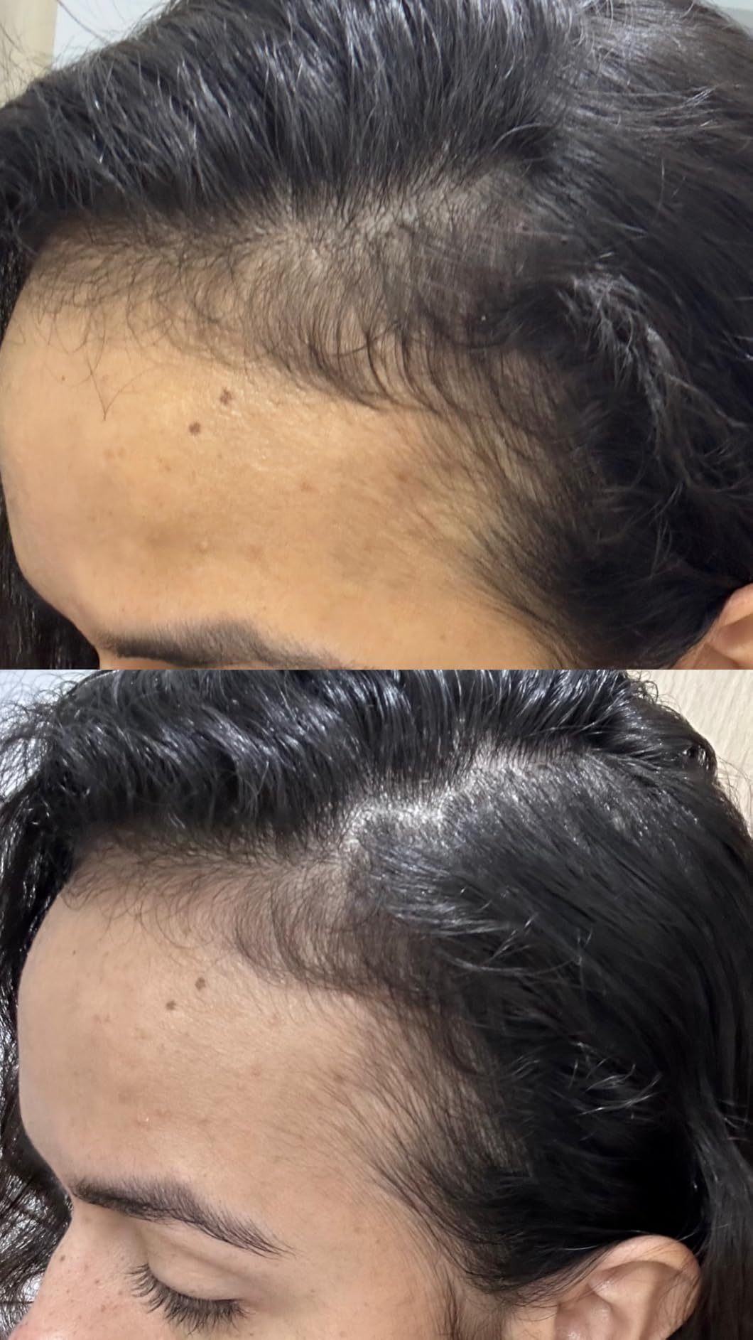 Nutrafol Women's Hair Serum, Supports Visibly Thicker and Stronger Hair, Vegan, Lightweight and Fast-Absorbing customer photo 2