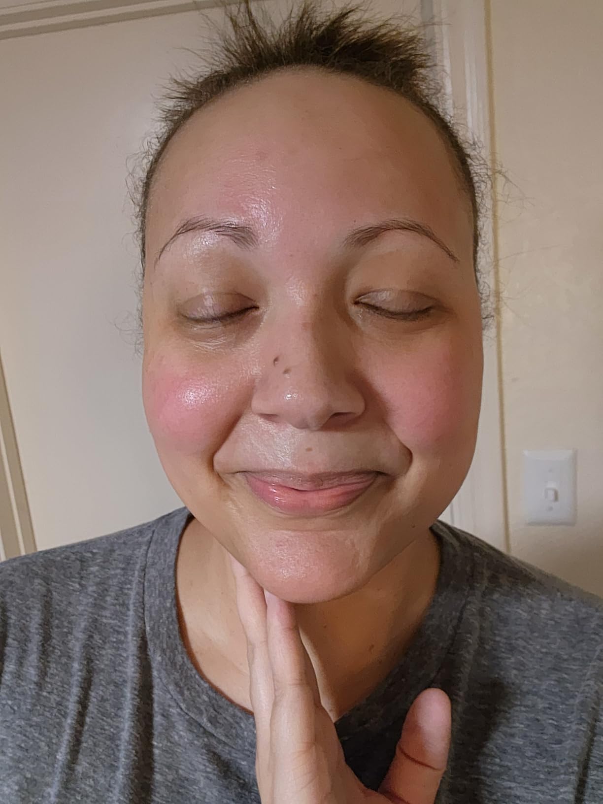 10% Azelaic Acid Serum with Niacinamide & Hyaluronic Acid - Rosacea Treatment For Face - Redness Relief, Blemish Relief, Brightening Skincare for Rosacea-Prone, Oily or Sensitive Skin, 30ml customer photo 1