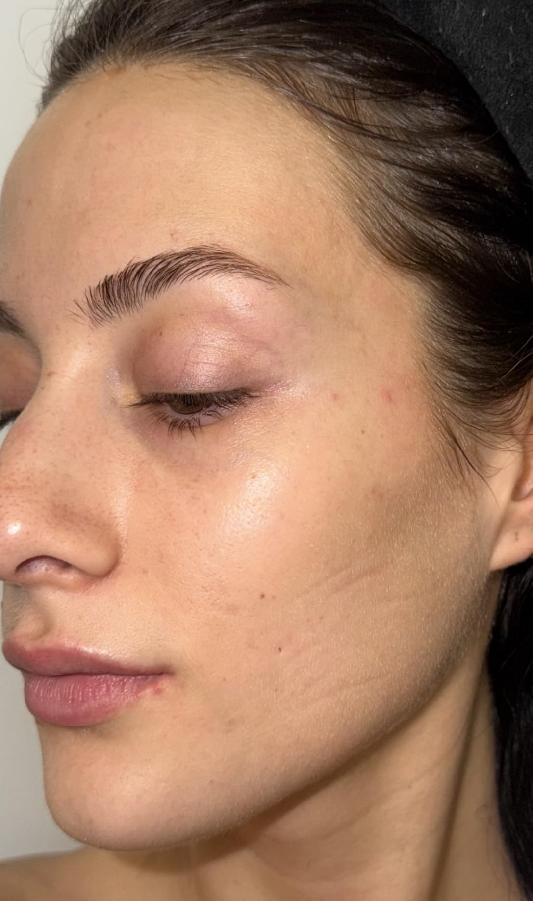 Good Molecules 10% Azelaic Acid Treatment for Face - Soothing Formula for Facial Redness & Uneven Tone - Brightens Dark Spots & Refines Texture - Vegan & Fragrance-Free Skincare (30ml / 1.01 fl oz.) customer photo 1