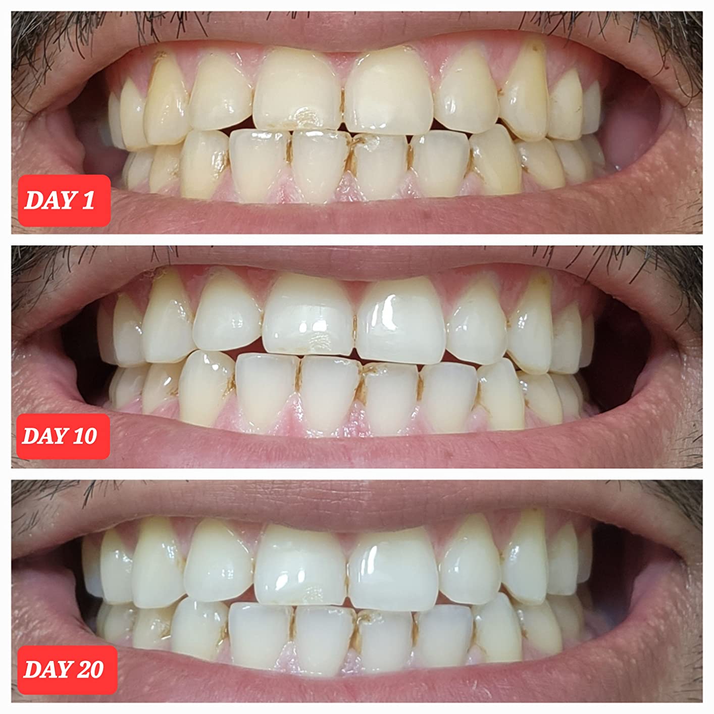 Crest 3D Whitestrips Professional Effects - Teeth Whitening Kit, 22 Treatments (20 + 2 Bonus), Each with 1 Upper/1Lower, 44 Strips - Crest 3DWhite Teeth Whitening Strips customer photo 2