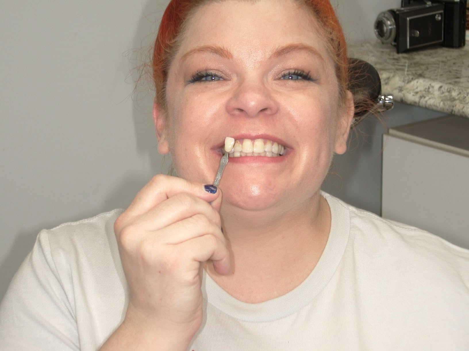 SNOW Diamond Wired Whitening Kit - Sensitive Teeth Whitening, Whitens & Repairs Teeth, 6 Months Treatment customer photo 1