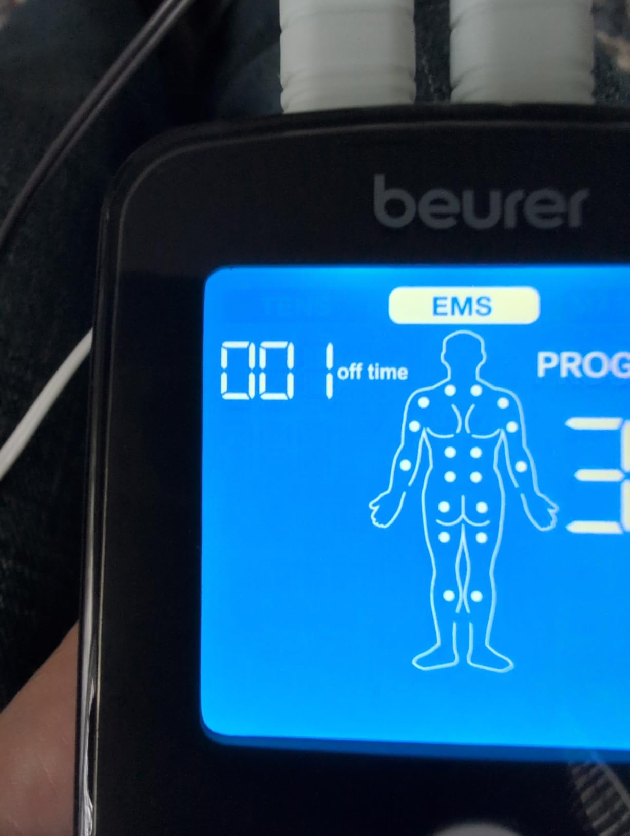 Beurer EM59 Digital 3-in-1 TENS Unit, EMS & Heat Therapy for Pain Relief & Relaxation, Muscle Stimulator with 2 Adjustable Channels, 64 Applications, Timer Function customer photo 2