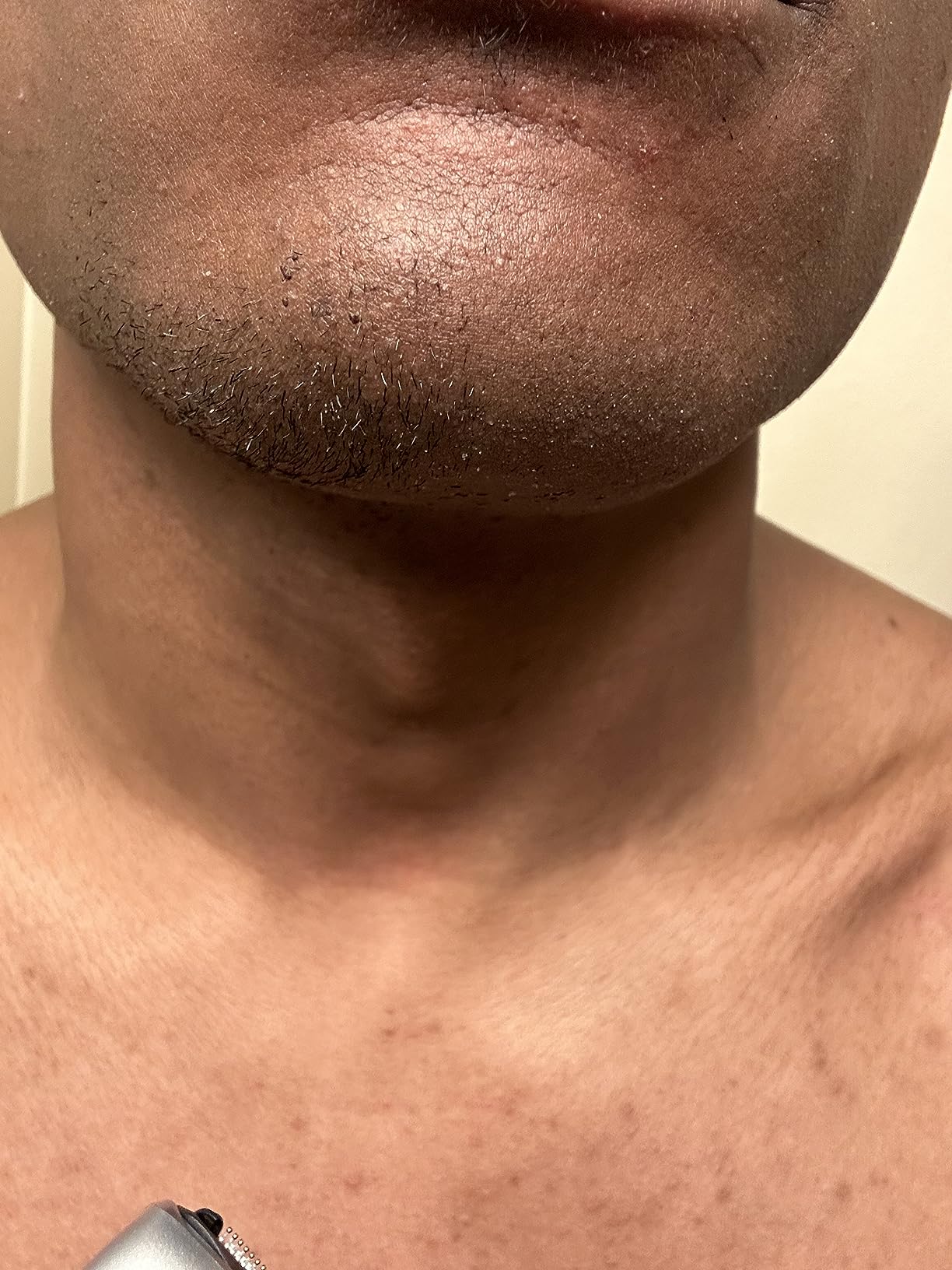 Philips Bodygroom Series 5000, Showerproof Groin and Body Trimmer, Close and Comfortable Shave, Complete Body Grooming Including Back, 60 Min. Runtime, Model BG5025/40 customer photo 2
