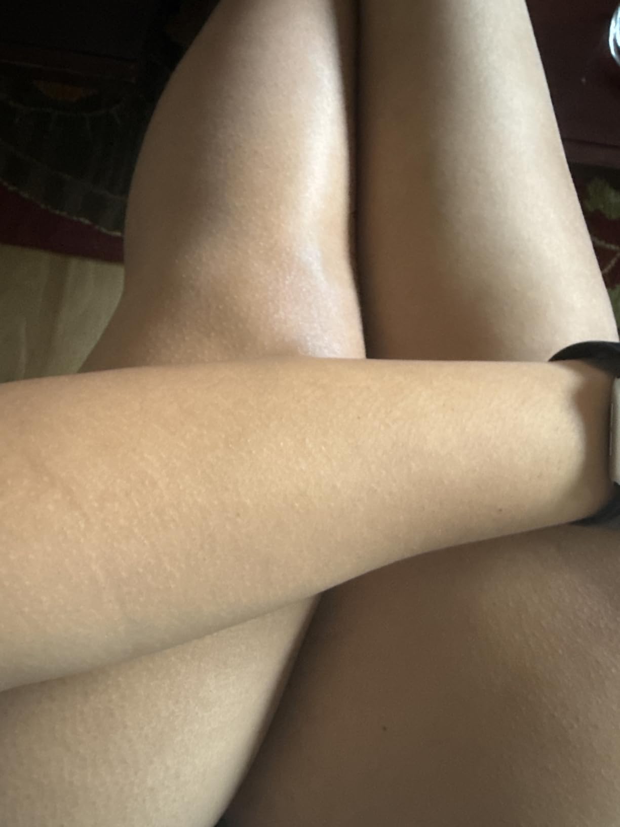 Braun Smart IPL, Skin i·Expert Pro 7, VOGUE's Best Hair Removal Device, IPL Hair Removal for Women and Men, Permanent Laser Hair Reduction At-Home, World's 1st Smart App, 3 Heads, IPL7243 customer photo 2