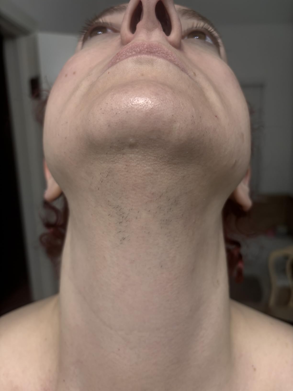 Finequin Laser Hair Removal for Women and Men, Air 15 Ice-cooling IPL Device Hair Removal for Nearly Painless & Long-Lasting Results From Home, 3 Modes & Auto Flashing for Fast Full Body Hair Removal customer photo 1