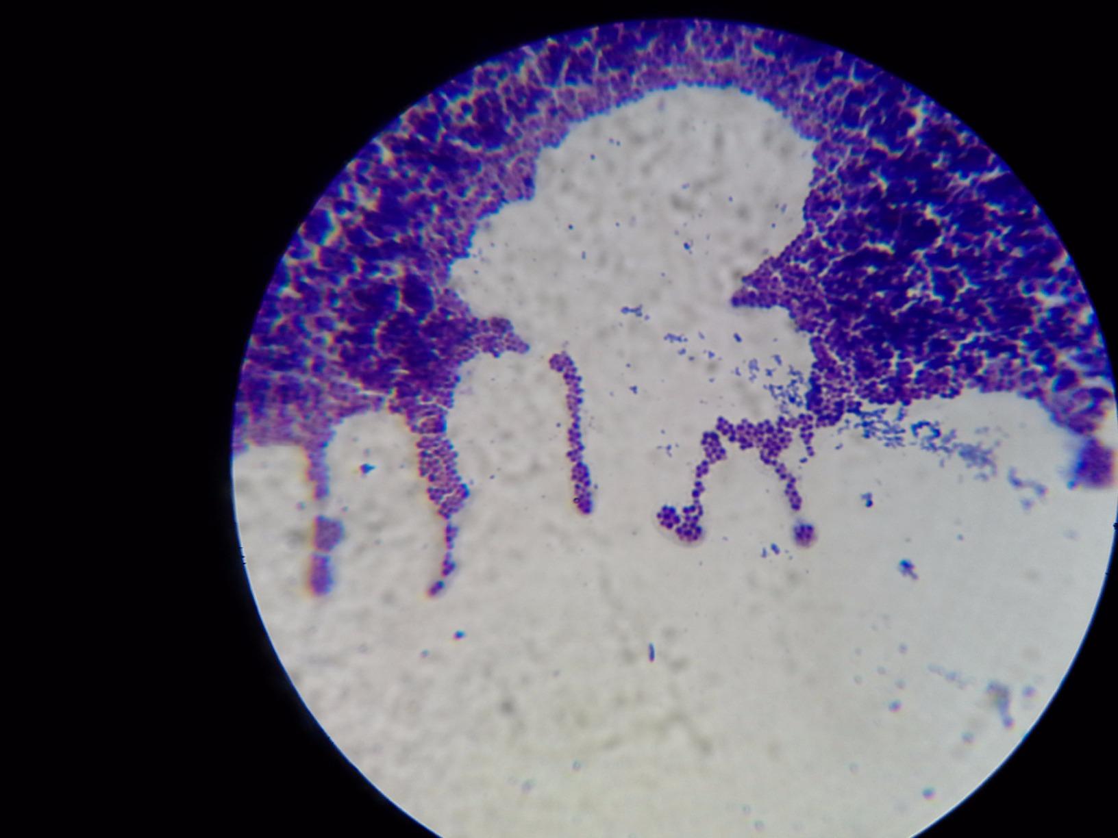 OMAX 40X-2000X LED Binocular Compound Lab Microscope w/ Double Layer Mechanical Stage + Blank Slides, Cover Slips, & Lens Cleaning Paper, M82ES-SC100-LP100 customer photo 2